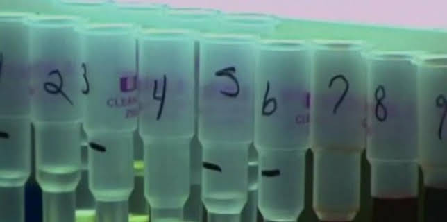 22:20: Dr. G - Beruf: Gerichtsmedizinerin | Sat1 Gold | 1/12 2026