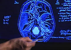 Autopsie - Mysteriöse Todesfälle