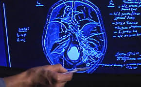 Autopsie - Mysteriöse Todesfälle