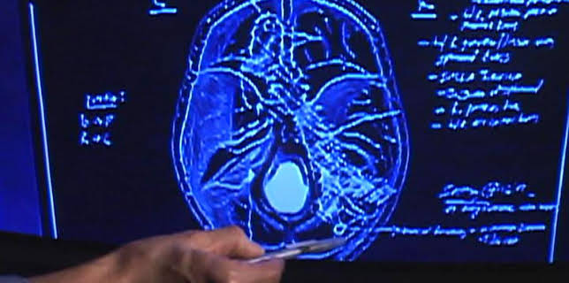 01:10: Autopsie - Mysteriöse Todesfälle (S17 E9) (S17) | RTL 2 | 12/18 2025