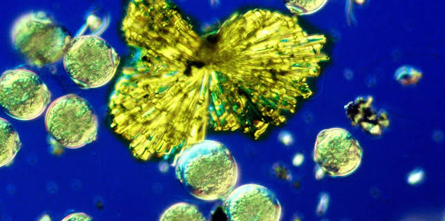 17:00: treffpunkt medizin | ARD Alpha | 2/28 2026