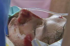 The Critical Hour: Shock Trauma: The Final Farewell