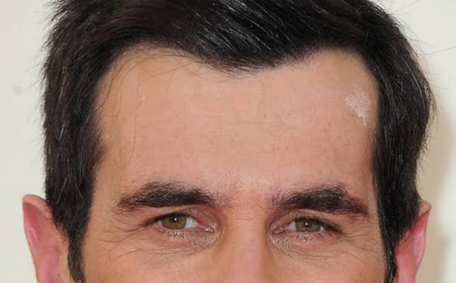 Ty Burrell