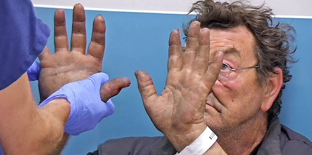 12:10 AM: 24 Hours in A&E | More 4 | 12/24 2025