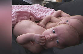 Make Room for Multiples: Duffy Triplets