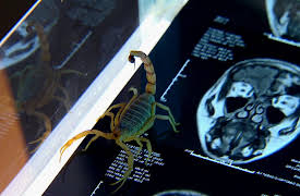 From Pain to Poison: Poison