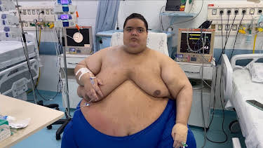 00:22: Mi vida con 300 kilos: Brasil | DKISS | 9/11 2026
