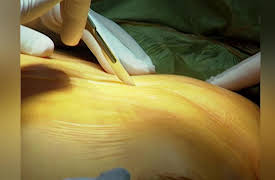 The Surgeons: Dr. Kshavjee