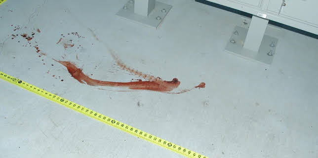 01:30: Medical Detectives - Geheimnisse der Gerichtsmedizin | VOX | 12/4 2025