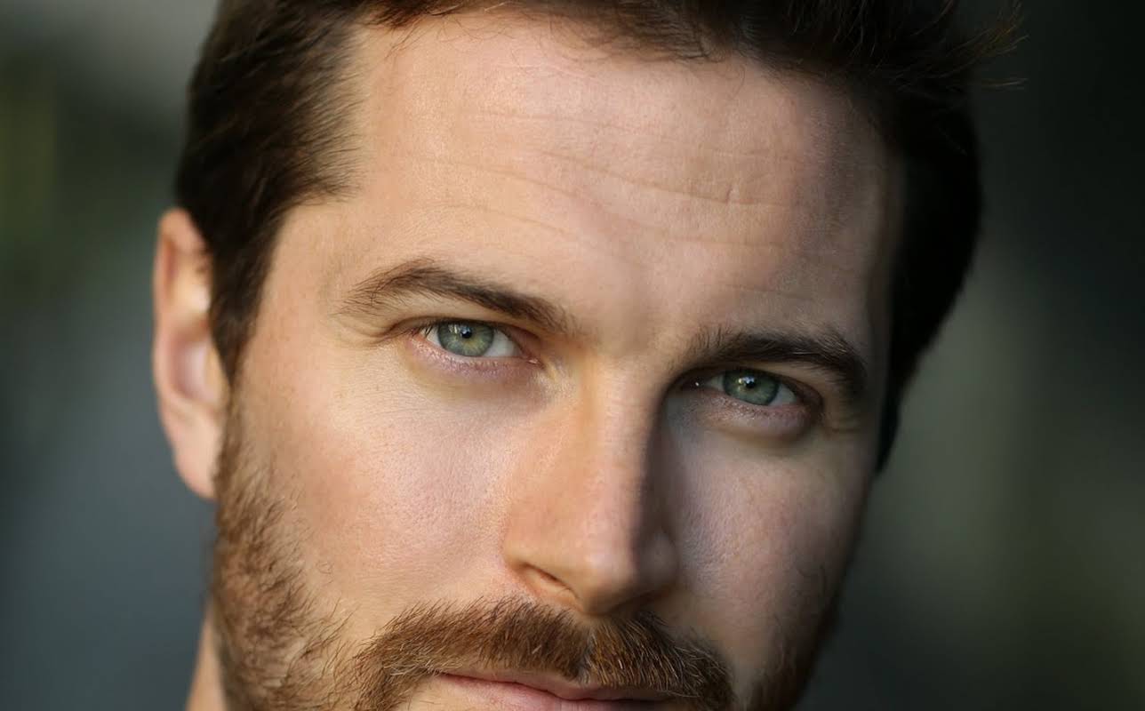 Kieran Bew