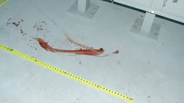 04:00: Medical Detectives - Geheimnisse der Gerichtsmedizin | VOX | 4/22 2026