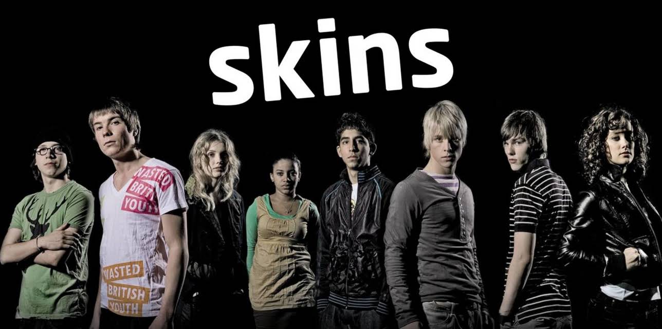 Skins UK