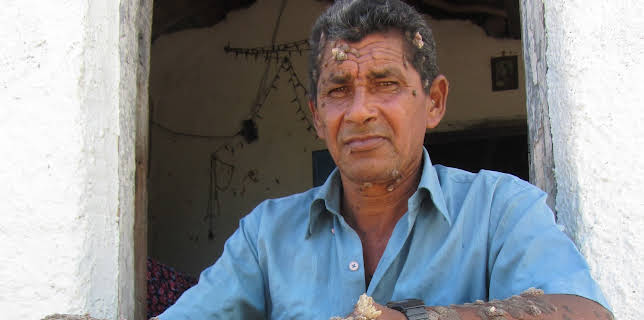 23:20: Body Bizarre (S6 E4) (S6) | TLC | 11/20 2025