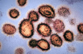 Coronavirus, Explained: This Pandemic