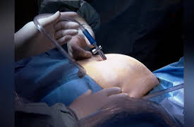 The Surgeons: Dr. Murphy