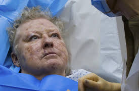 Save My Skin: It's a Bit Soul Destroying