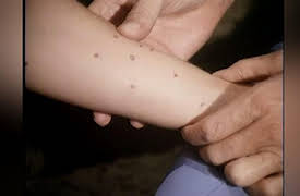 Marcus Welby, M.D. Season One: The Chemistry Of Hope