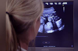 Giuliana & Bill Season 5: Boy or Girl?