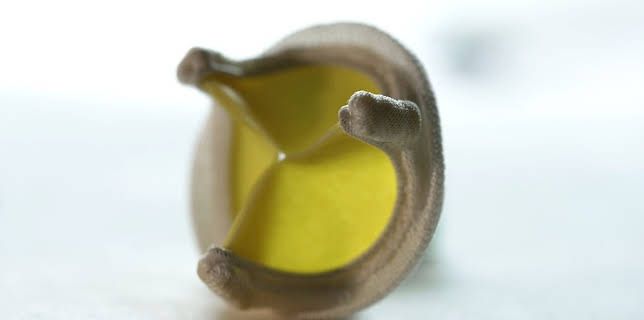 11:40: aktiv und gesund | SR Fernsehen | 3/24 2026