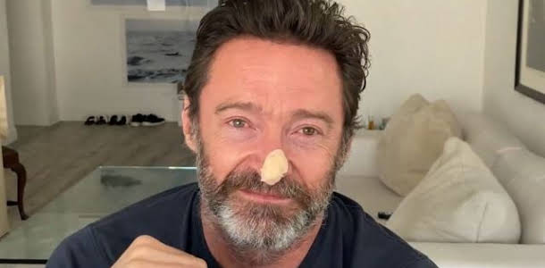 Hugh Jackman tests negative in skin cancer risk studies