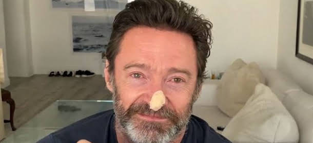 Hugh Jackman tests negative in skin cancer risk studies