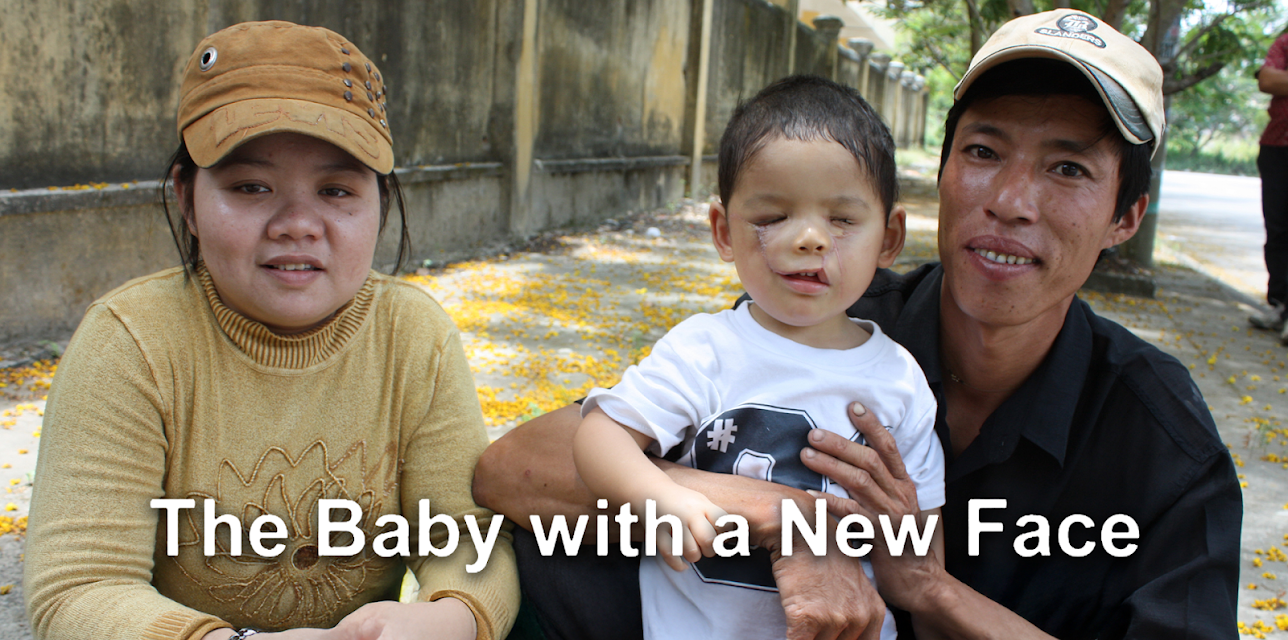 The Baby with a New Face (2017)