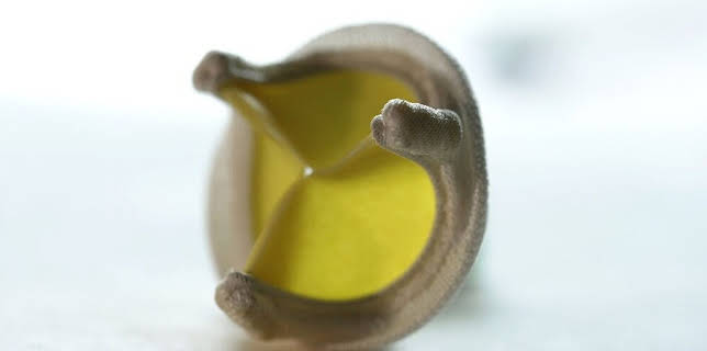 11:40: aktiv und gesund | SWR Fernsehen RP | 3/24 2026