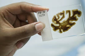 The Alzheimer's Project: Season 1: The Alzheimer's Project: Momentum in Science (Part 2)