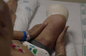 Diabetes The Disease Thats Killing My Family: Facing Consequences