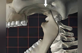 How to Sing: Releasing Jaw Tension