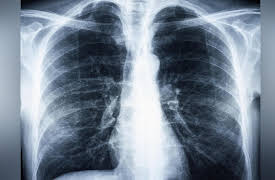 Medical School for Everyone: Grand Rounds Cases: I Can't Walk