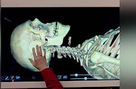 How We Move: The Gross Anatomy of Motion: Digital Cadaver Lesson: Head, Neck, and Torso