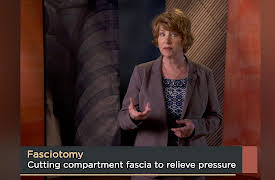 How We Move: The Gross Anatomy of Motion: Knee to Ankle: The Anatomical Leg