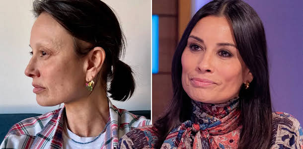 Melanie Sykes opens up about autoimmune condition and hair loss