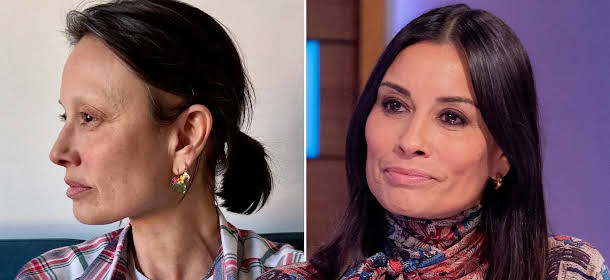 Melanie Sykes opens up about autoimmune condition and hair loss