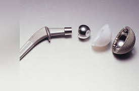 The Nature of Matter: Understanding the Physical World: Materials for Body Implants