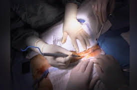 The Surgeons: Dr. Cohen