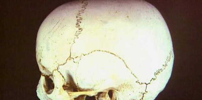 01:50: Medical Detectives - Geheimnisse der Gerichtsmedizin | VOX | 3/27 2026