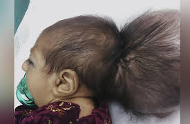 Body Bizarre Season 1: My Baby's Got An Extra Head