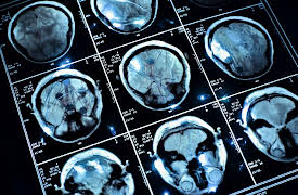 Why You Are Who You Are: Investigations into Human Personality: Personality and the Brain