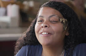 About Face: Marked at Birth