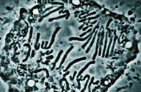 Snabbkurs i historia: Genetik