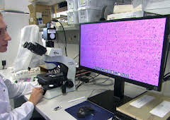 Neue Waffen gegen Krebs - Therapieverstärkung bei Tumorerkrankungen