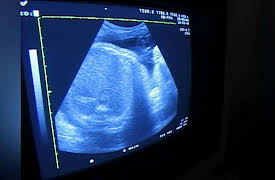 Birth Stories: Episode 5