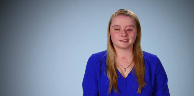 02:05: Kirurgiske katastrofer | TV 2 Livsstil | 11/10 2025