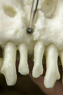 15:35: Así se hace (MAX): Réplicas de esqueletos | Discovery | 4/9 2026