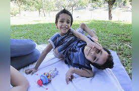 Body Bizarre Season 1: Joined at the Waist