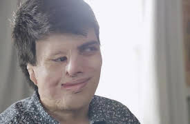 About Face: A Real Life Picasso