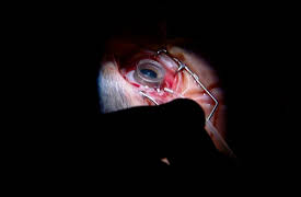 The Surgeons: Dr. Devenyi