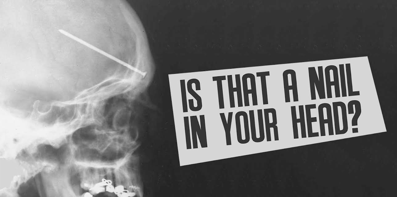 Is That A Nail In Your Head?